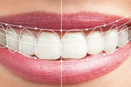 transforming-smiles-with-technology:-the-benefits-of-digital-smile-design