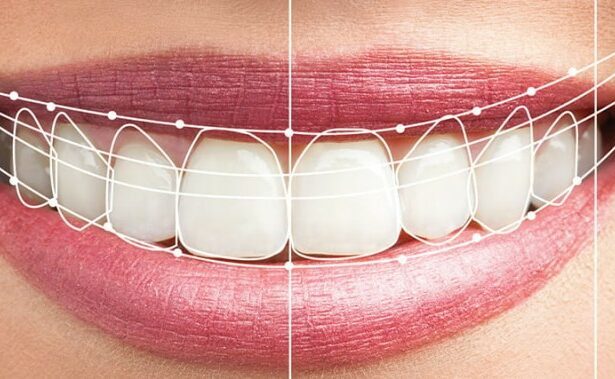 transforming-smiles-with-technology:-the-benefits-of-digital-smile-design