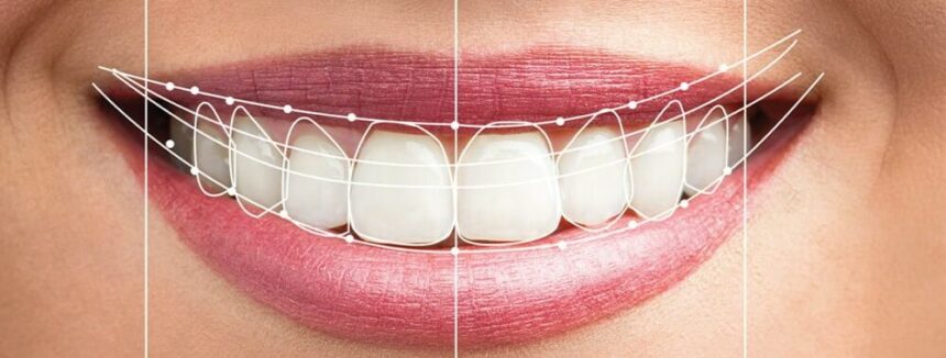 transforming-smiles-with-technology:-the-benefits-of-digital-smile-design